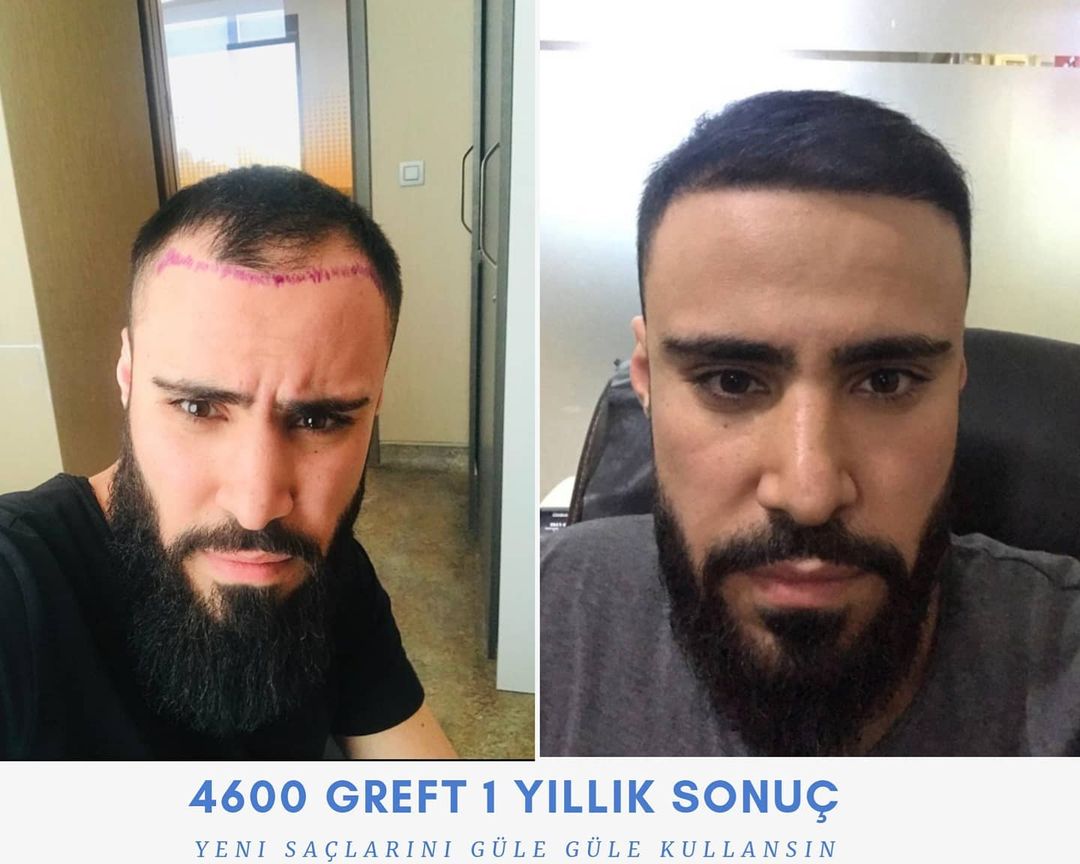 4600 GREFT 1 YLLIK SONUÇ