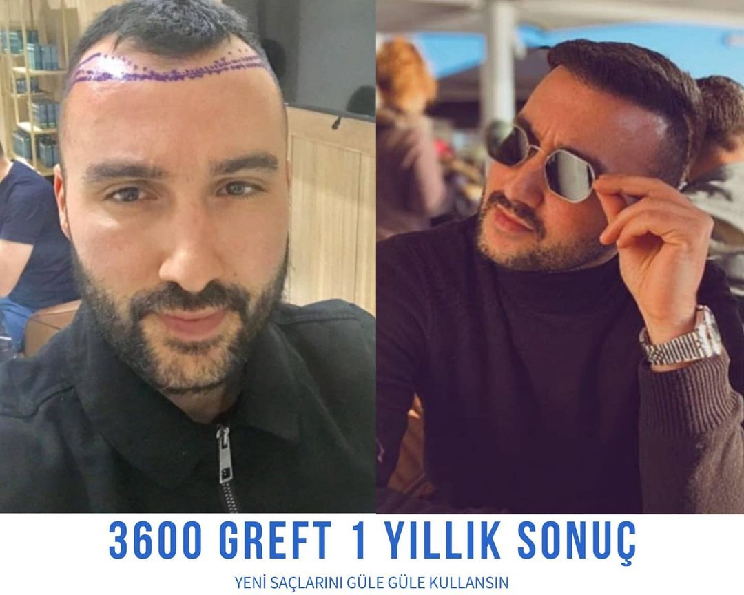 3600 GREFT 1 YLLIK SONUÇ