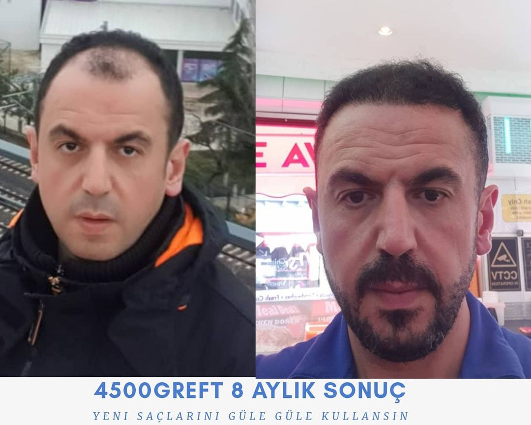 4500 GREFT 8 AYLIK SONUÇ