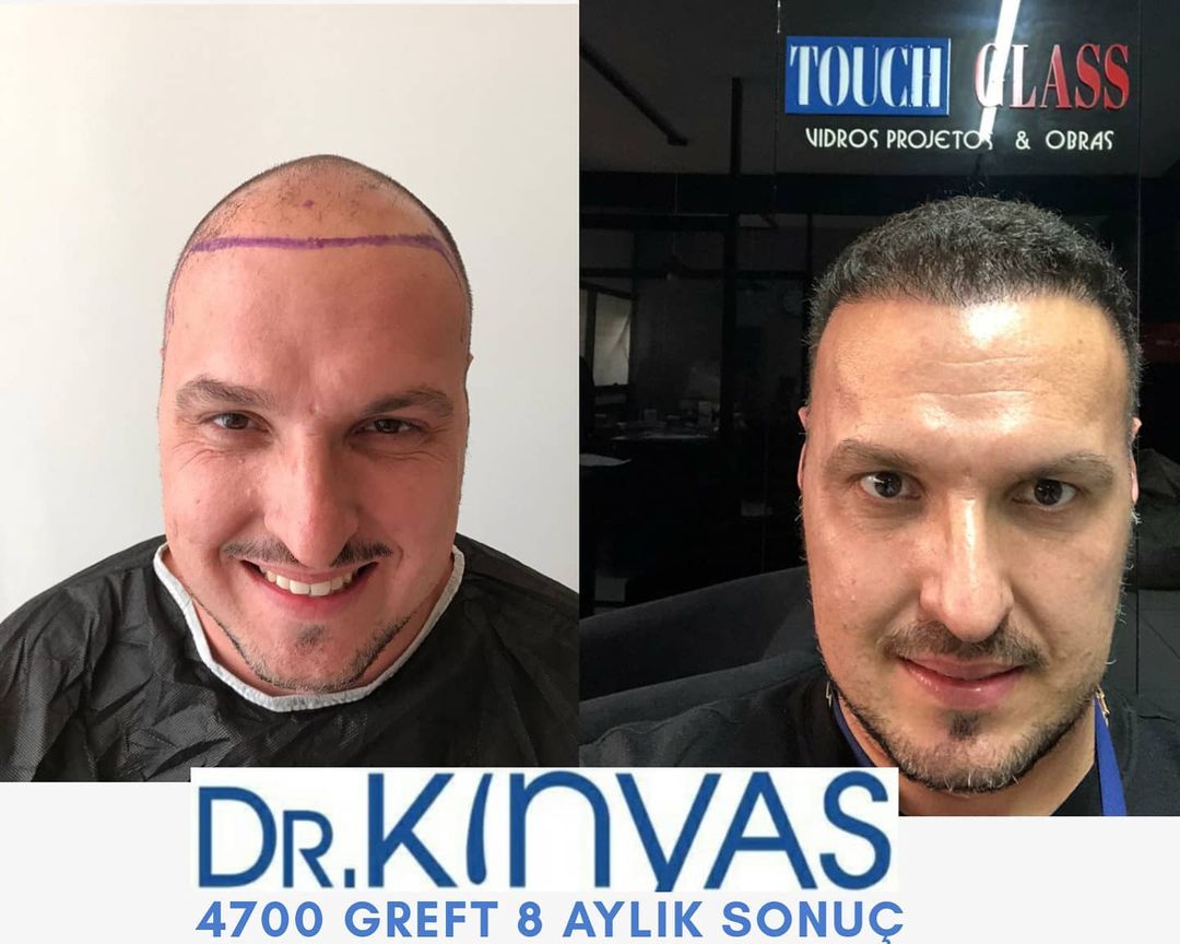 4700 GREFT 8 AYLIK SONUÇ