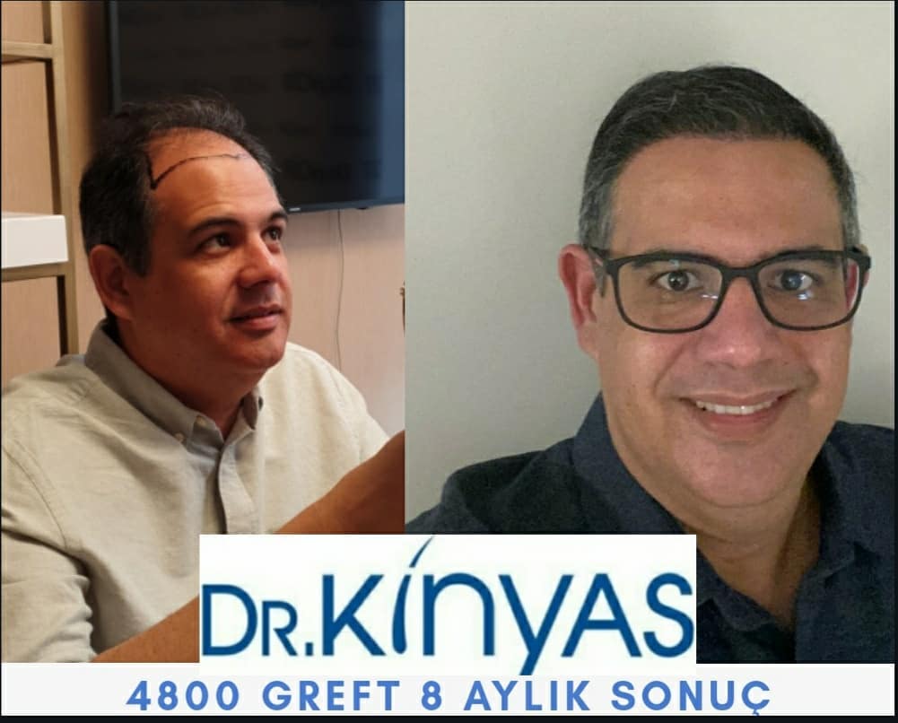 4800 GREFT 8 AYLIK SONUÇ