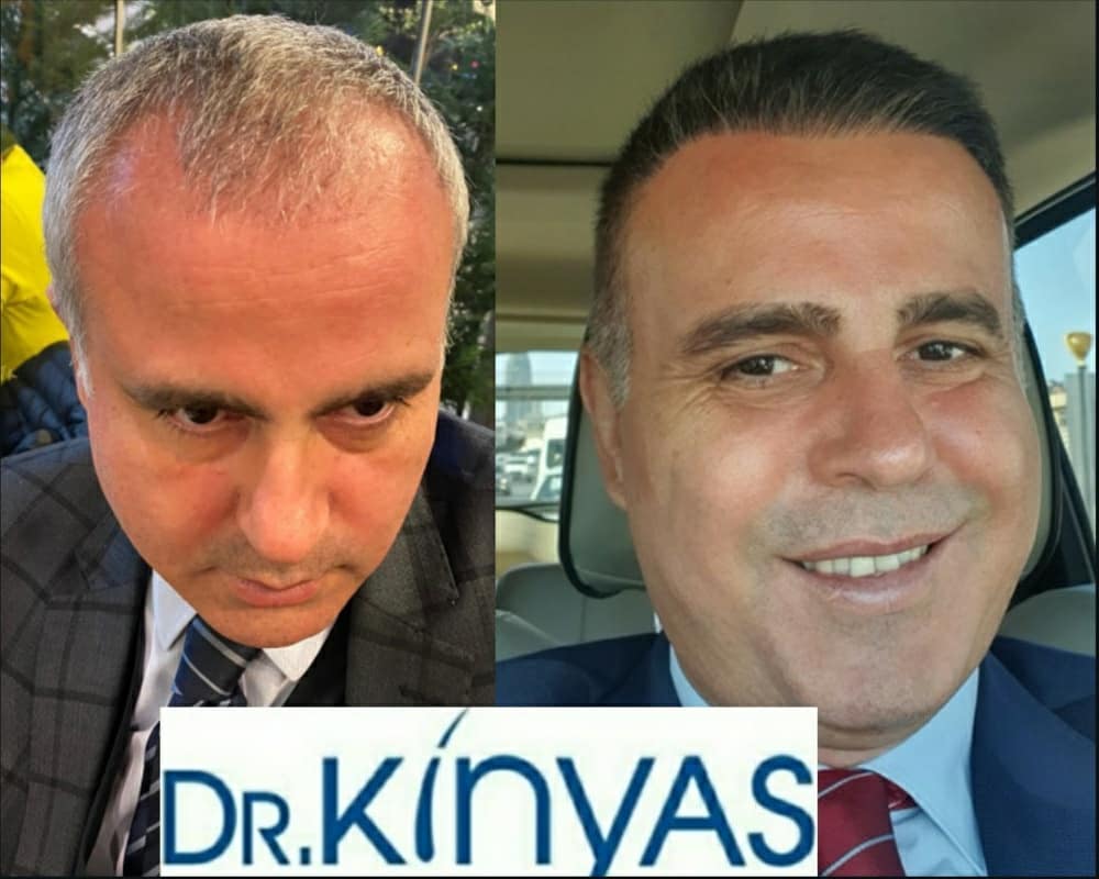 ÖNCESİ - SONRASI
