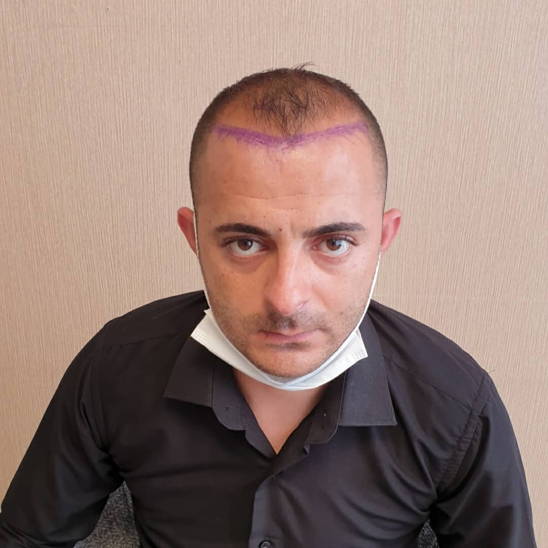 4500 GREFT 7 AYLIK SONUÇ
