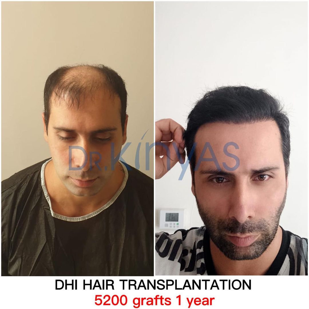 5200 GREFT 1 YILLIK SONUÇ