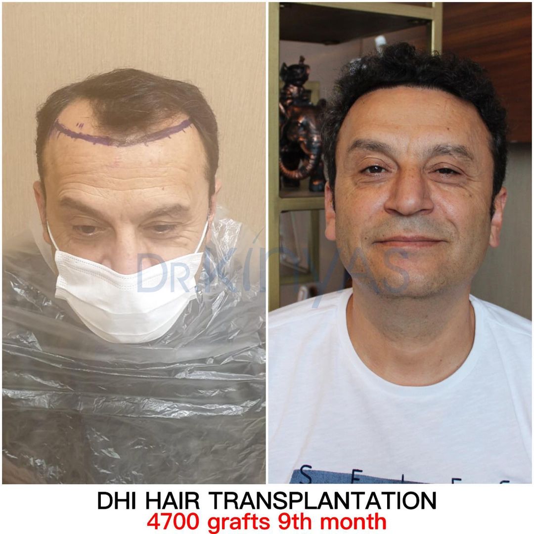 4700 GREFT 9 AYLIK SONUÇ
